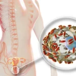 deaths from boric acid suppositories