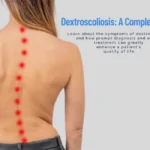 dextroscoliosis